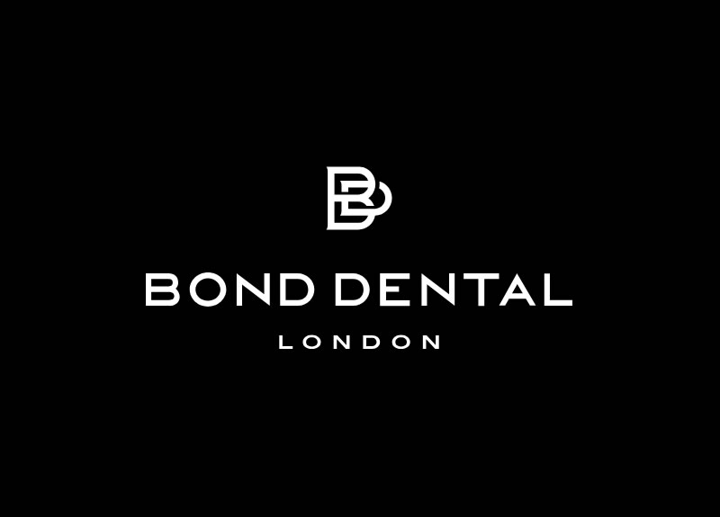 Blog - Bond Dental London