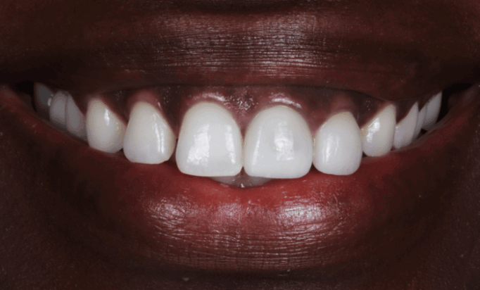 After -Bond Dental London