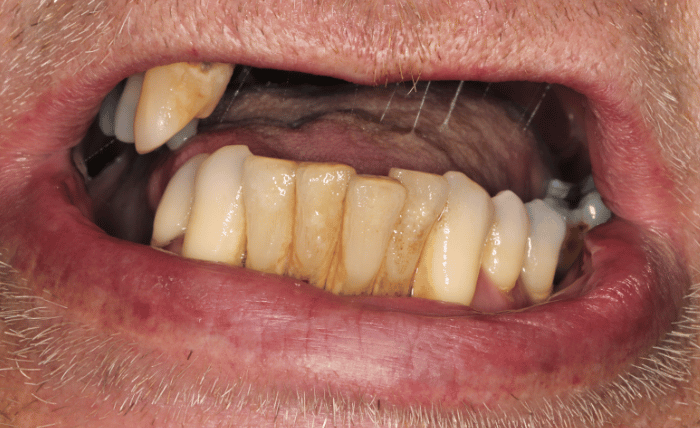 Before - Bond Dental London