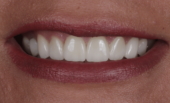After -Bond Dental London