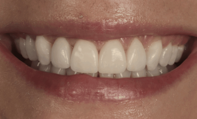 After -Bond Dental London