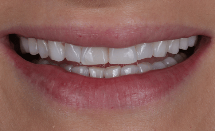 Before - Bond Dental London