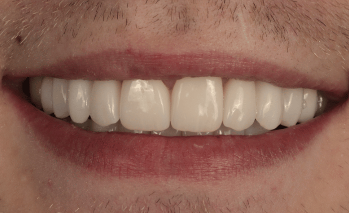 After -Bond Dental London