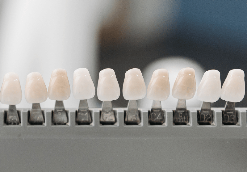 Blog -Bond Dental London