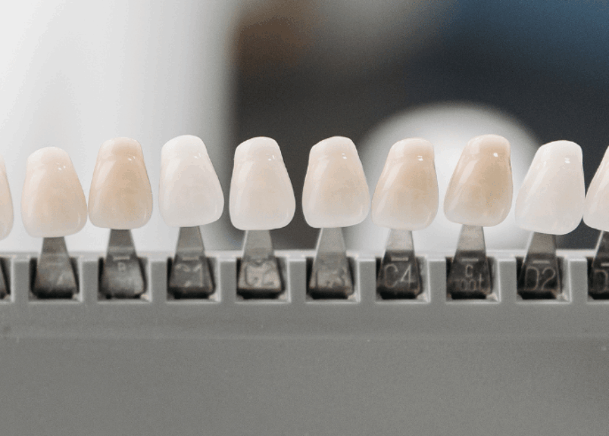 Blog Inner - Bond Dental London