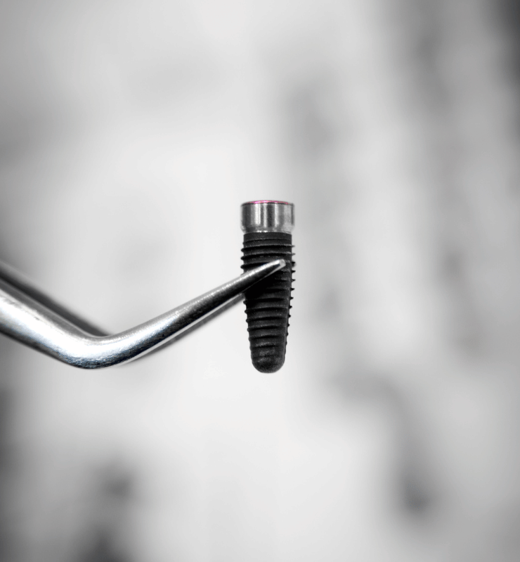 Treatment -  Bond Dental London