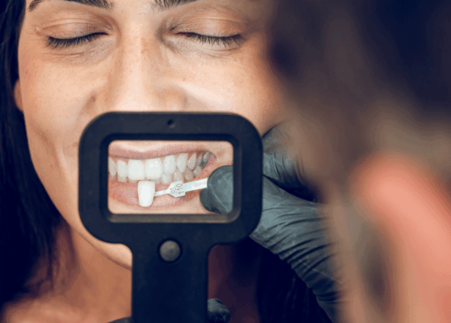 Blog Inner - Bond Dental London