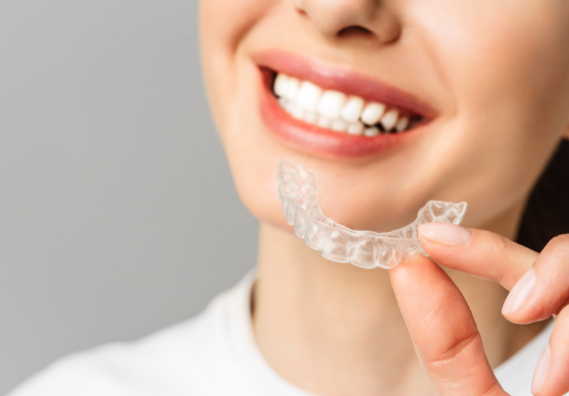 Invisalign Benefits