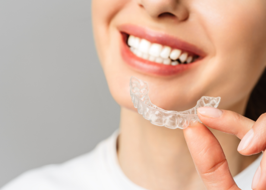 Invisalign Benefits