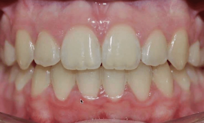 After -Bond Dental London