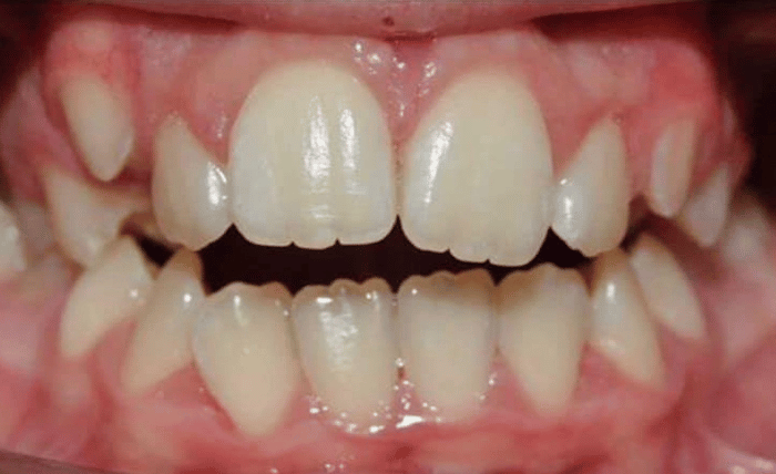 Before - Bond Dental London