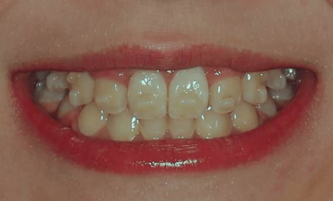 After -Bond Dental London
