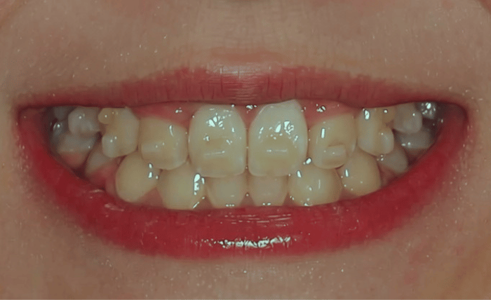 After -Bond Dental London