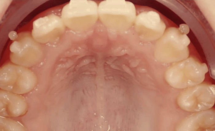 After -Bond Dental London