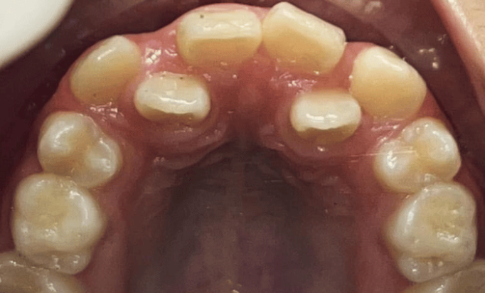 Before - Bond Dental London