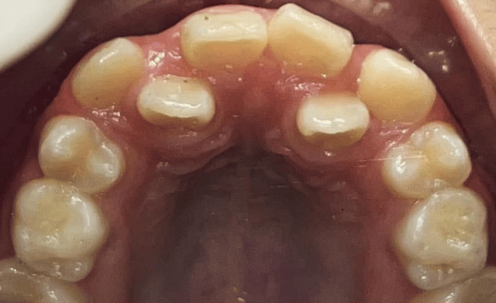Before - Bond Dental London