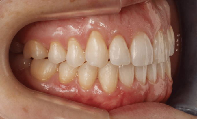After -Bond Dental London