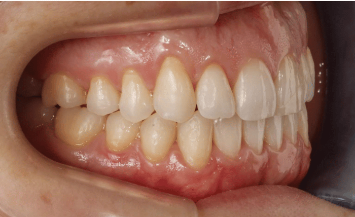 After -Bond Dental London