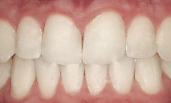After -Bond Dental London