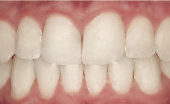 After -Bond Dental London