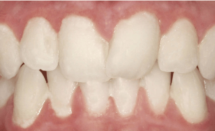 Before - Bond Dental London