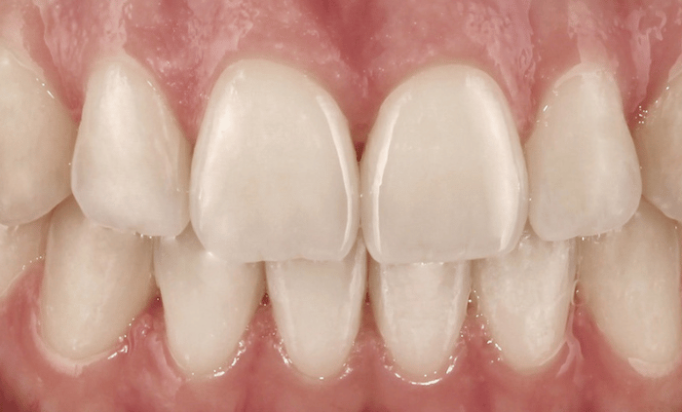 After -Bond Dental London