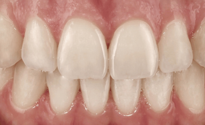 After -Bond Dental London