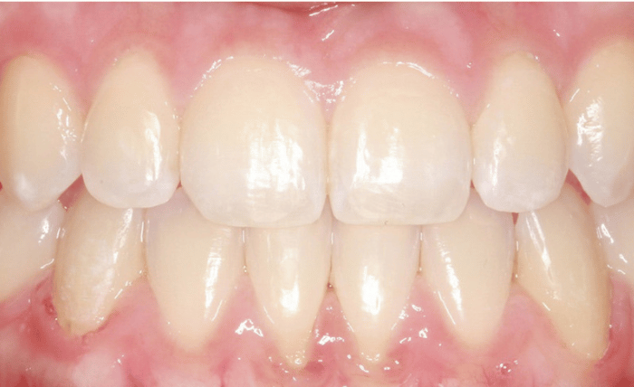 After -Bond Dental London