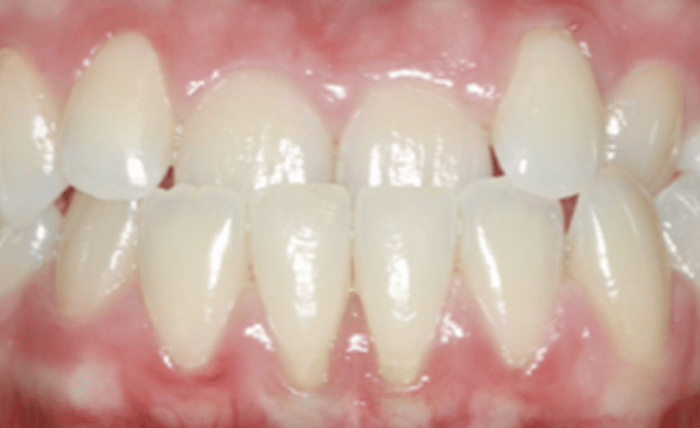 Before - Bond Dental London