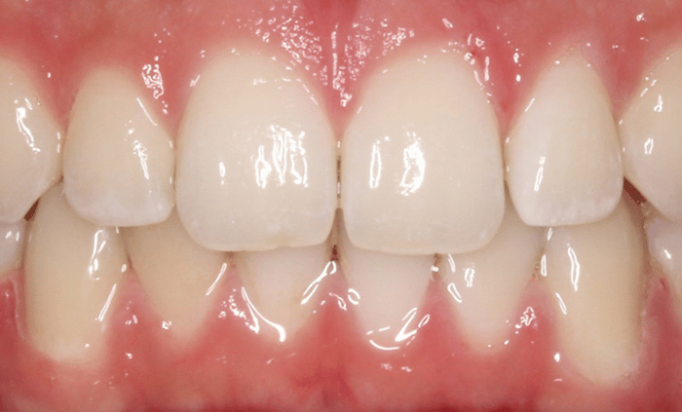 After -Bond Dental London