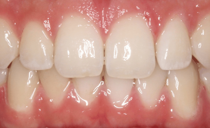 After -Bond Dental London