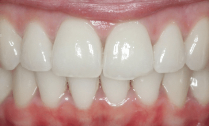 After -Bond Dental London