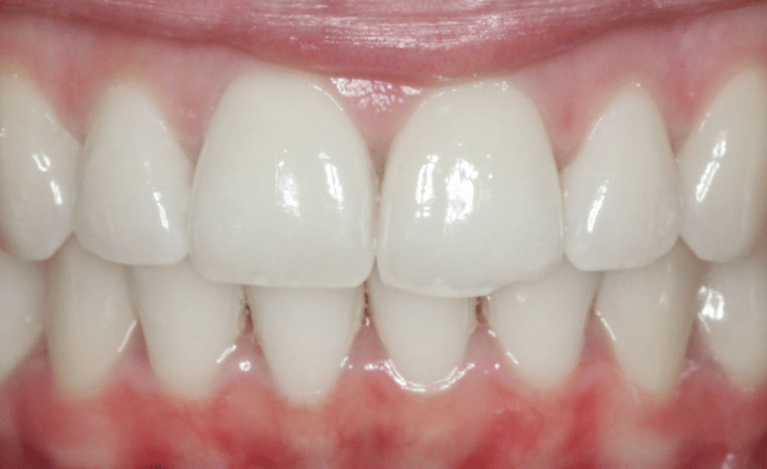 After -Bond Dental London