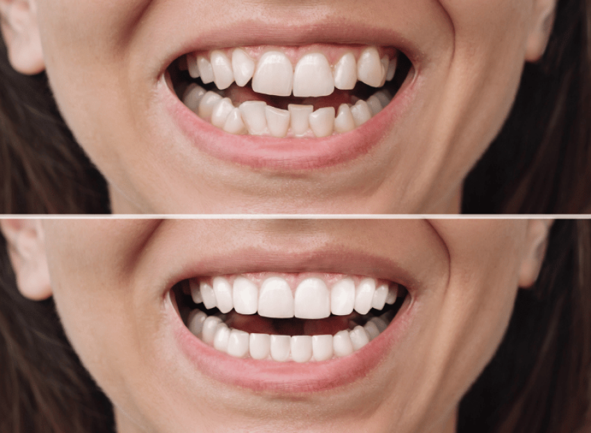 Bond Dental London