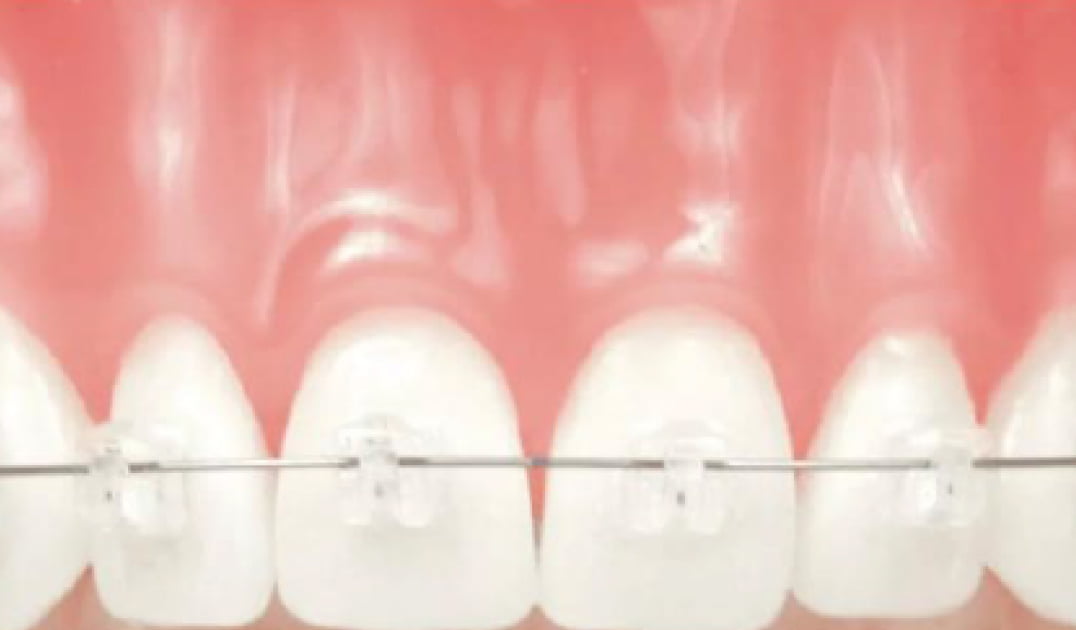 Bond Dental London