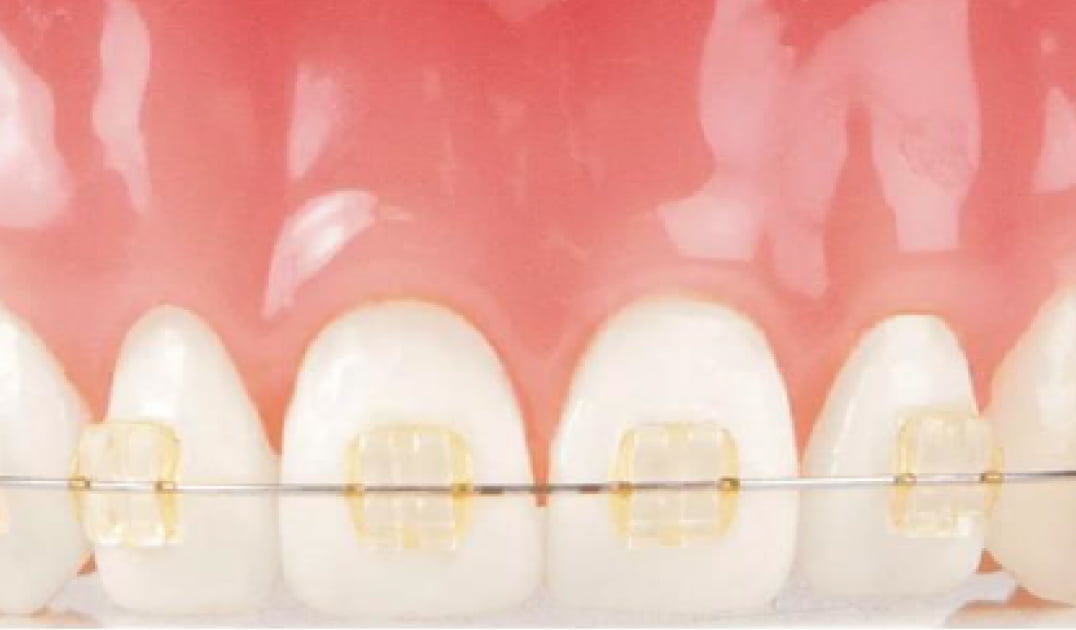 Bond Dental London
